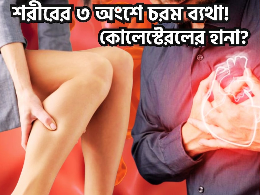 হাই কোলেস্টেরল এমন একটি সমস্যা একে শরীরের শত্রু হিসাবে বিবেচনা করা হয়ে থাকে ৷ এরফলে ব্লাডপ্রেশার, ডায়াবেটিস, হার্ট অ্যাটাক, করোনারি আর্টারি ডিজিজ সম্ভাবনা তৈরি হয় ৷ প্রতীকী ছবি ৷ হাই কোলেস্টেরল এমন একটি সমস্যা একে শরীরের শত্রু হিসাবে বিবেচনা করা হয়ে থাকে ৷ এরফলে ব্লাডপ্রেশার, ডায়াবেটিস, হার্ট অ্যাটাক, করোনারি আর্টারি ডিজিজ সম্ভাবনা তৈরি হয় ৷ প্রতীকী ছবি ৷