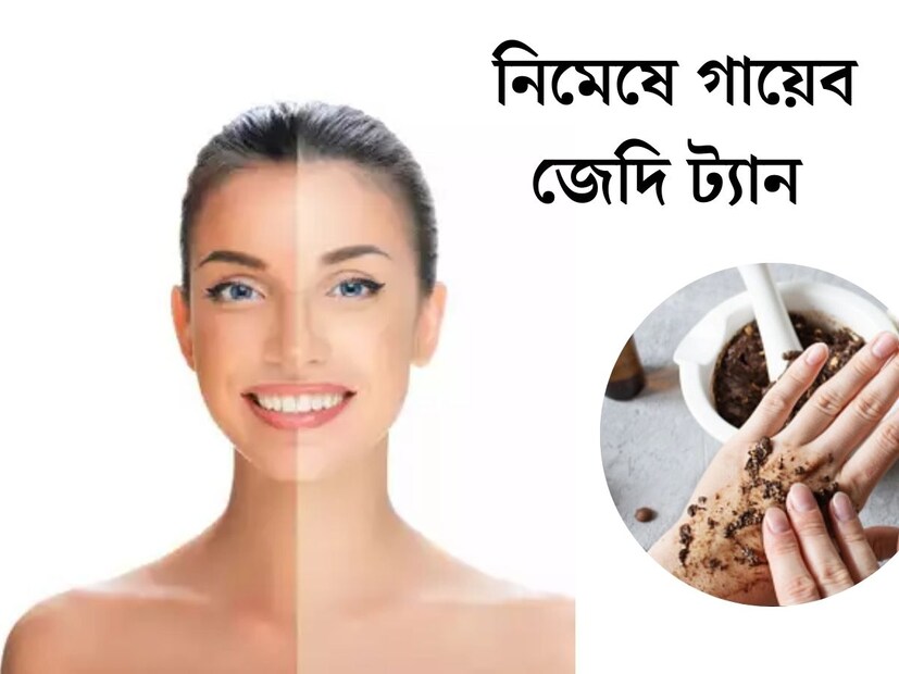 গরমে ত্বকের যত্ন নেওয়া খুবই জরুরি। প্রখর সূর্যের আলোতেই না চাইলেও বেরোতে হচ্ছে বাইরে৷ ফলে অবধারিত ভাবেই পড়ছে ট্যান৷ ত্বকের উপর এই জেদি কালো দাগ কীভাবে তুলবেন?