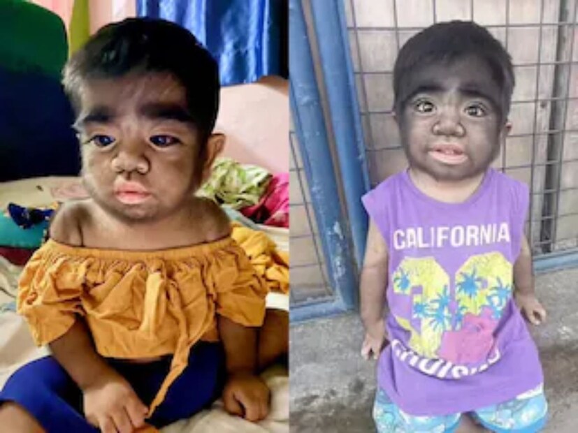 গর্ভাবস্থায় নারীদের সঠিক খাওয়া দাওয়া অত্যন্ত গুরুত্বপূর্ণ৷ ভুল খাবার খেলে তার প্রভাব পড়তে পারে গর্ভস্থ শিশুর শরীরে৷ তাই গর্ভাবস্থায় সঠিক খাবার খাওয়ার পরামর্শ দেন চিকিৎসকরা৷ অনেক সময় মায়ের কোনও ভুল খাবার থেকে শিশু বিরল রোগের স্বীকারও হতে পারে৷ 
