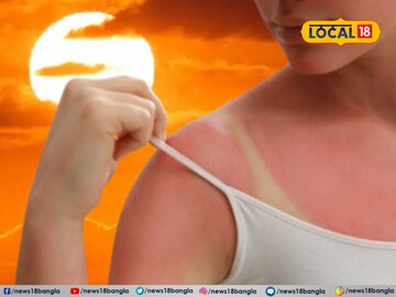 SPF দেখে দামি সানস্ক্রিন কিনছেন? রোদে চামড়ার পোড়া আটকাতে 'এই' উপাদান শ্রেষ্ঠ!