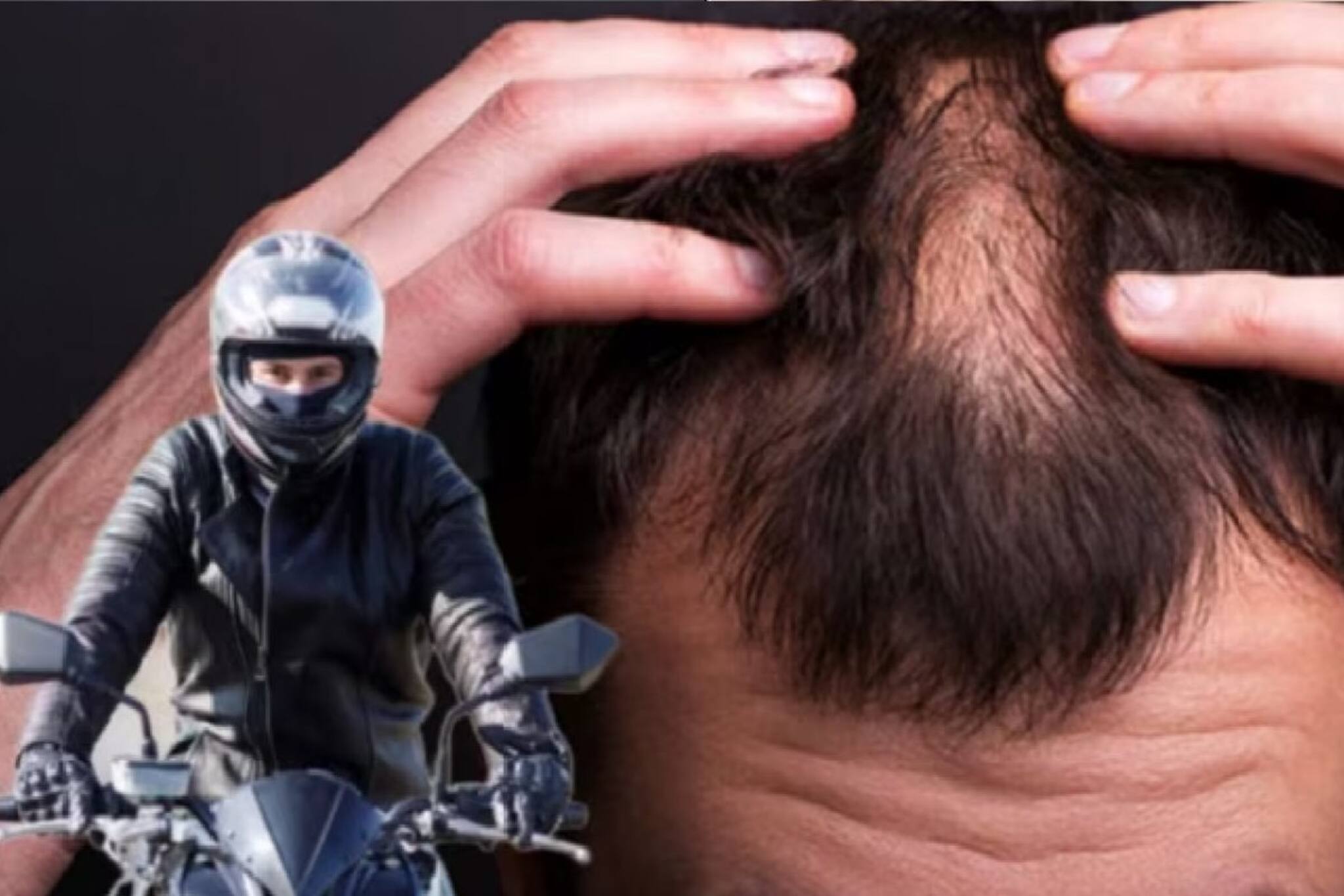 হেলমেট পরলে চুল ঝরে যায়? আসল সত্যিটা কী? উত্তর দিলেন বিশেষজ্ঞরা