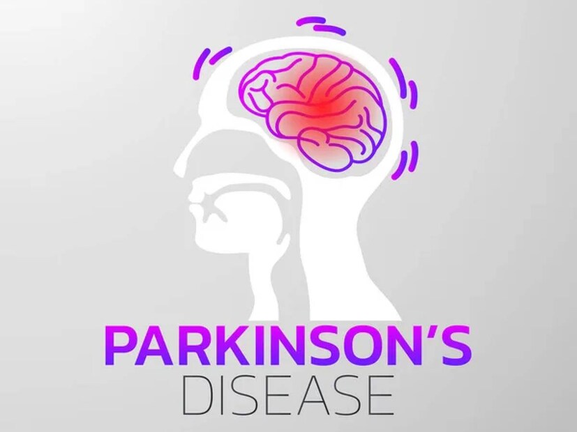 Parkinson's disease Symptoms: নারায়ণা হাসপাতাল, হাওড়ার কনসালটেন্ট নিউরোলজিস্ট ডাঃ অরিন্দম ঘোষ জানালেন, ‘‘এটি কেবল বয়স্কদের হয়, তা কিন্তু নয়, ১০% পর্যন্ত তরুণদেরও পারকিনসন রোগের সম্মুখীন হয়।”