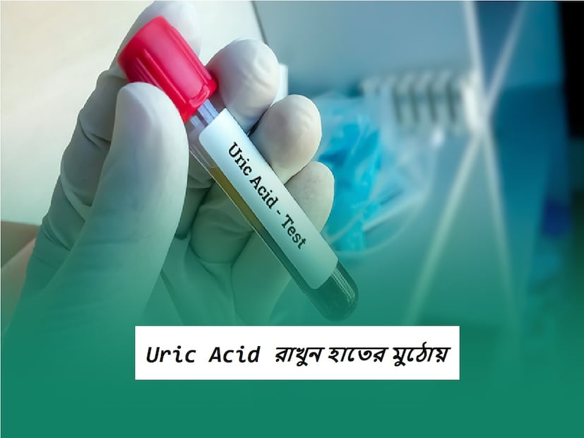 এই মত নিউজ ১৮ বাংলার ব্যক্তিগত মত নয়, প্রচলিত মতের ভিত্তিতেই এই প্রতিবেদন৷ ফলে সঠিক ফল পেতে বিশেষজ্ঞের পরামর্শ নিন৷ Photo- Representative