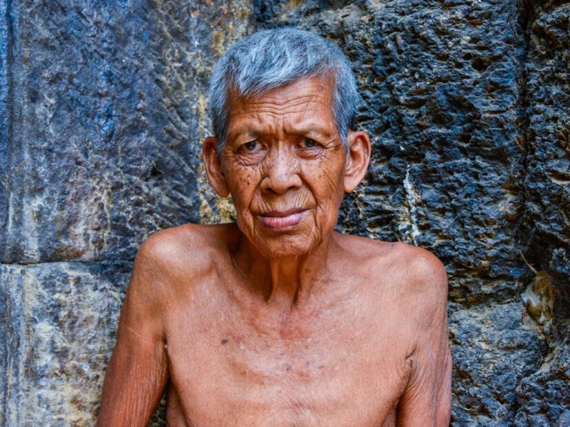স্ক্যাল্প, ভ্রু: বার্ধক্যই ধূসর চুলের আসল কারণ। যদিও একমাত্র কারণ নয়। শুধু মাথার চুলই নয়, ভ্রু এবং অন্যান্য অংশের চুল ও সাদা হয়ে যায়। তবে কানের উপরের অংশের চুল দ্রুত সাদা হয়।
