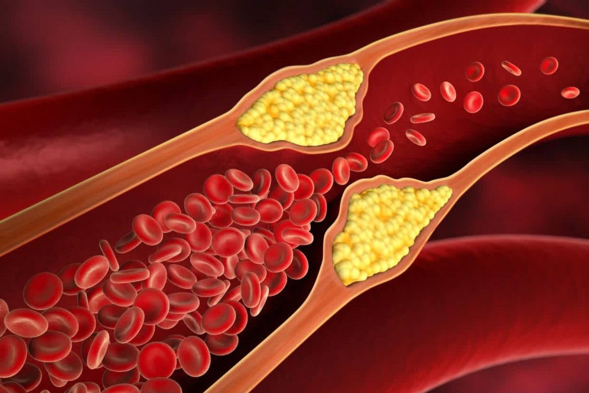 এক নিমেষে ছু-মন্তর হবে বদ কোলেস্টেরল..! এই পানীয়তে চুমুক দিলেই কামাল, ৩০ দিনে ফল