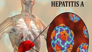 ভয়ঙ্কর রূপ নিচ্ছে হেপাটাইটিস এ