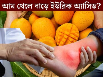 দেদার খাচ্ছেন আম? বাড়ছে নাকি ইউরিক অ‍্যাসিড? বড় সত‍্যি জানেন না ৯৯% লোকজন