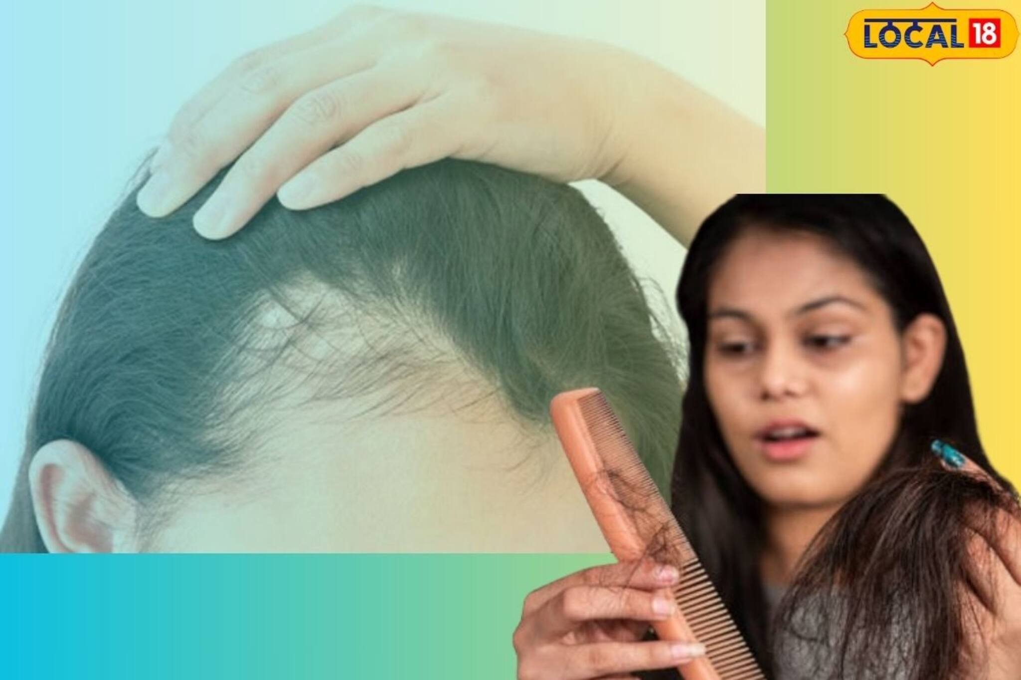 চিরুনি ছোঁয়ালেই চুল, অকালে টাক না পড়ে যায়! ঘরেই সেরা শ্যাম্পু বানিয়ে নিন চটজলদি