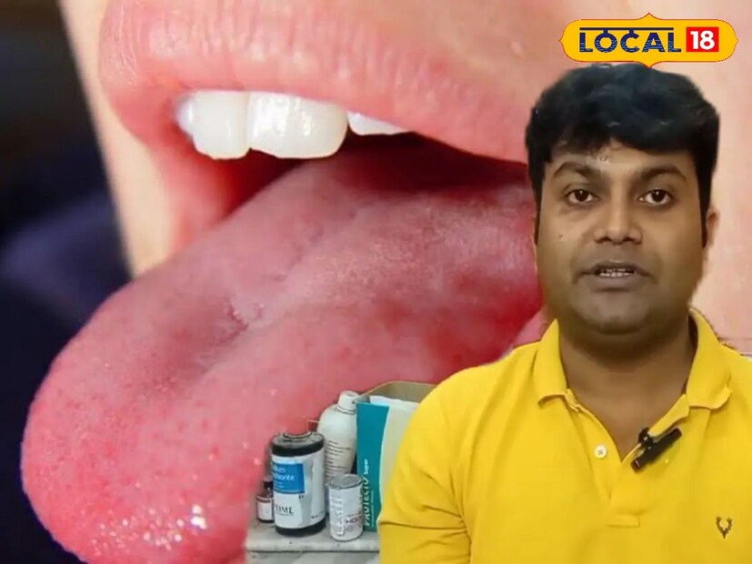 এই বিষয়ে চিকিৎসক অর্ক ধারার পরামর্শ, জীবনযাত্রার মানের পরিবর্তন ক্যানসার রোগীর সংখ্যা বাড়াচ্ছে। সংখ্যার দিক থেকে আমাদের দেশে নারীদের জরায়ু ও স্তন ক্যানসার এবং পুরুষদের ফুসফুস ক্যানসারের পরই মুখগহ্বরের ক্যানসারের রোগী বেশি দেখা যায়। যাঁরা মুখের ক্যানসারে আক্রান্ত হন, তাঁদের বেশির ভাগের বয়স ৪০ বছরের বেশি। নারীদের তুলনায় পুরুষেরাই এই ক্যানসারে আক্রান্ত হন বেশি। 