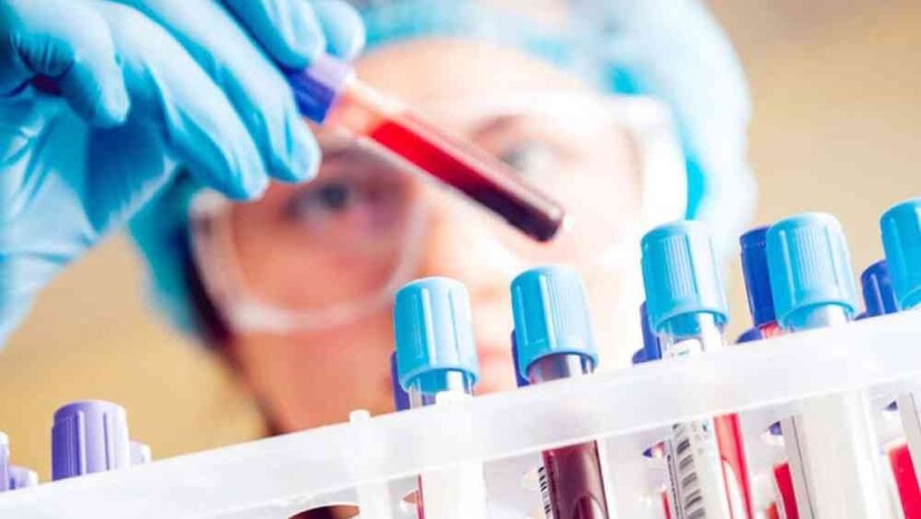 প্রতিদিন আমাদের শরীর সর্বোচ্চ ২৩০০ মিলিগ্রাম পর্যন্ত সোডিয়াম গ্রহণ করতে পারে। কিন্তু যাঁদের উচ্চ রক্তচাপ বা হার্টের সমস্যা রয়েছে, তাঁদের প্রতিদিন ১৫০০ মিলিগ্রামের বেশি সোডিয়াম খাওয়া উচিত নয়। যদিও শরীরের প্রতিদিন প্রয়োজন শুধুমাত্র ৫০০ মিলিগ্রাম সোডিয়াম। 