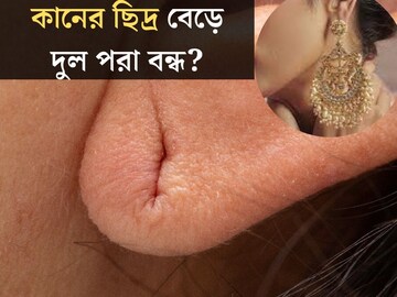 কানের ছিদ্র বেড়ে দুল পরা বন্ধ? একটা উপাদানেই হবে বিরাট কামাল...বাড়িতেই আছে