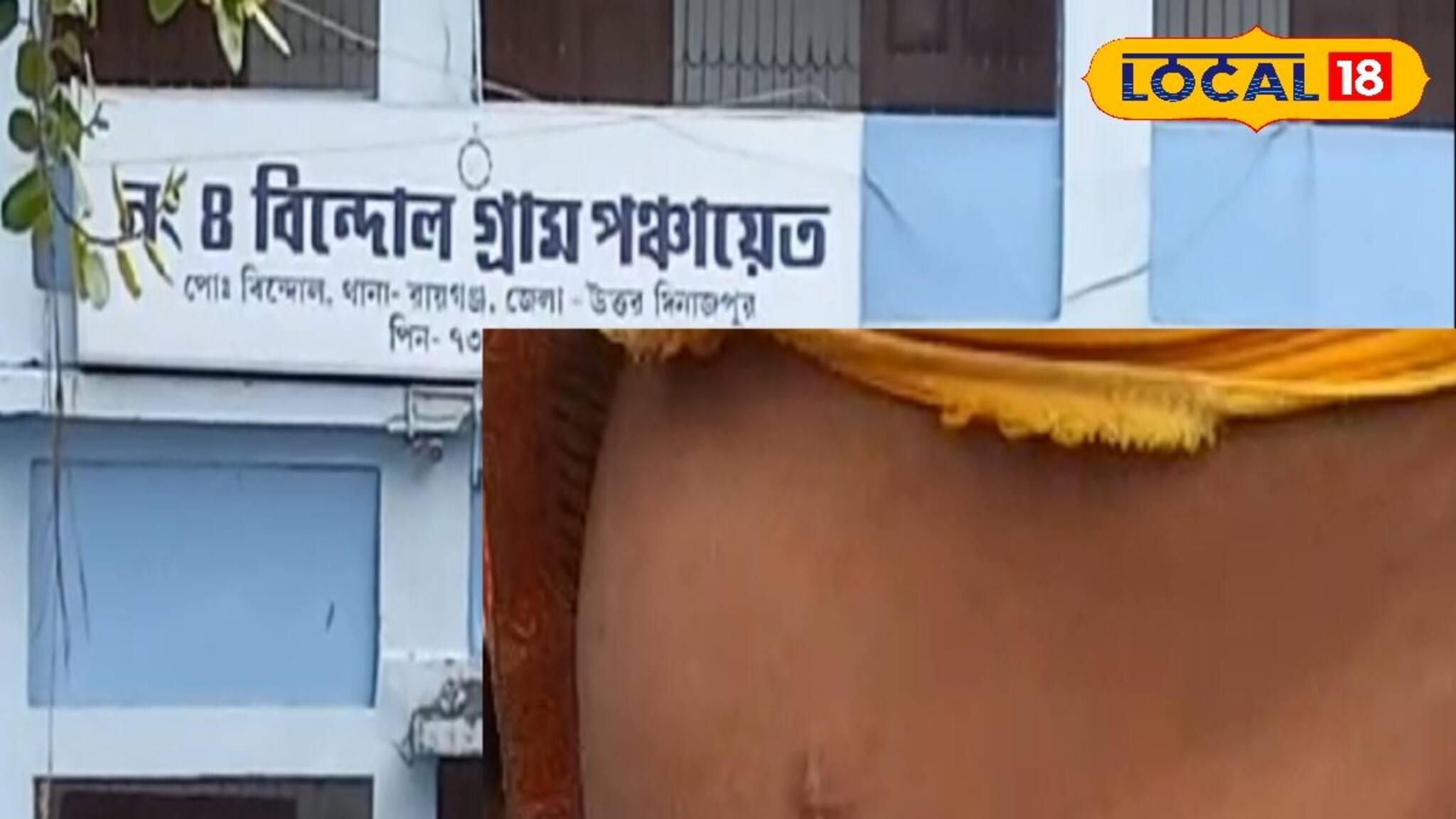 কিডনির সঙ্গে জড়িয়ে রয়েছে এ গ্রামের নাম! হাড়হিম করা ঘ‌টনা বাংলার এই গ্রামে