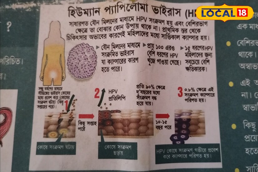 হিউমান প্যাপিলোমা ভাইরাস। সাধারণত যৌন মিলনের মাধ্যমে এই রোগ দেখা যায়।