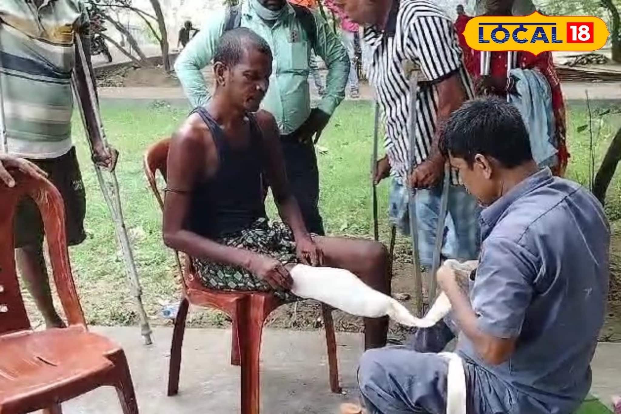 দুর্ঘটনা কেড়ে নিয়েছে কারও হাত, কারও পা! অসহায়দের সহায় হলেন আরামবাগের যুবক