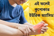 টক, মিষ্টি ফলেই কুপোকাত ইউরিক‍ অ‍্যাসিডের সমস‍্যা! দেহে জমে থাকা ময়লাও দূর হবে