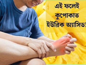 টক, মিষ্টি ফলেই কুপোকাত ইউরিক‍ অ‍্যাসিডের সমস‍্যা! দেহে জমে থাকা ময়লাও দূর হবে