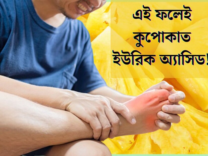 ডায়াবেটিস, কোলেস্টেরলের মতোই বর্তমানে একটি অতি চেনা সমস‍্যা হল ইউরিক অ‍্যাসিডের বৃদ্ধি। শরীরে ইউরিক অ‍্যাসিডের পরিমাণ বেড়ে গেলে জাঁকিয়ে বসে একাধিক রোগ। অনেক ধরনের সমস্যা হতে থাকে। তাই সুস্থ থাকতে ইউরিক অ‍্যাসিড নিয়ন্ত্রণে রাখা অত‍্যন্ত জরুরি। 