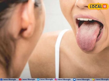 মুখের ক্যানসার আক্রান্তের সংখ্যা লাফিয়ে বেড়েছে, জিভে-গলায় এমন দাগ থাকলে সাবধান! মুখের ক্যানসার আক্রান্তের সংখ্যা লাফিয়ে বেড়েছে, জিভে-গলায় এমন দাগ থাকলে সাবধান!