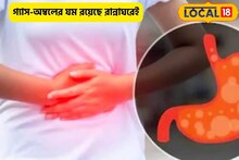 গ্যাস-অম্বলের পালাবে লেজ গুটিয়ে! শুধু ভরসা রাখুন রান্নাঘরের কয়েকটি মশলায়