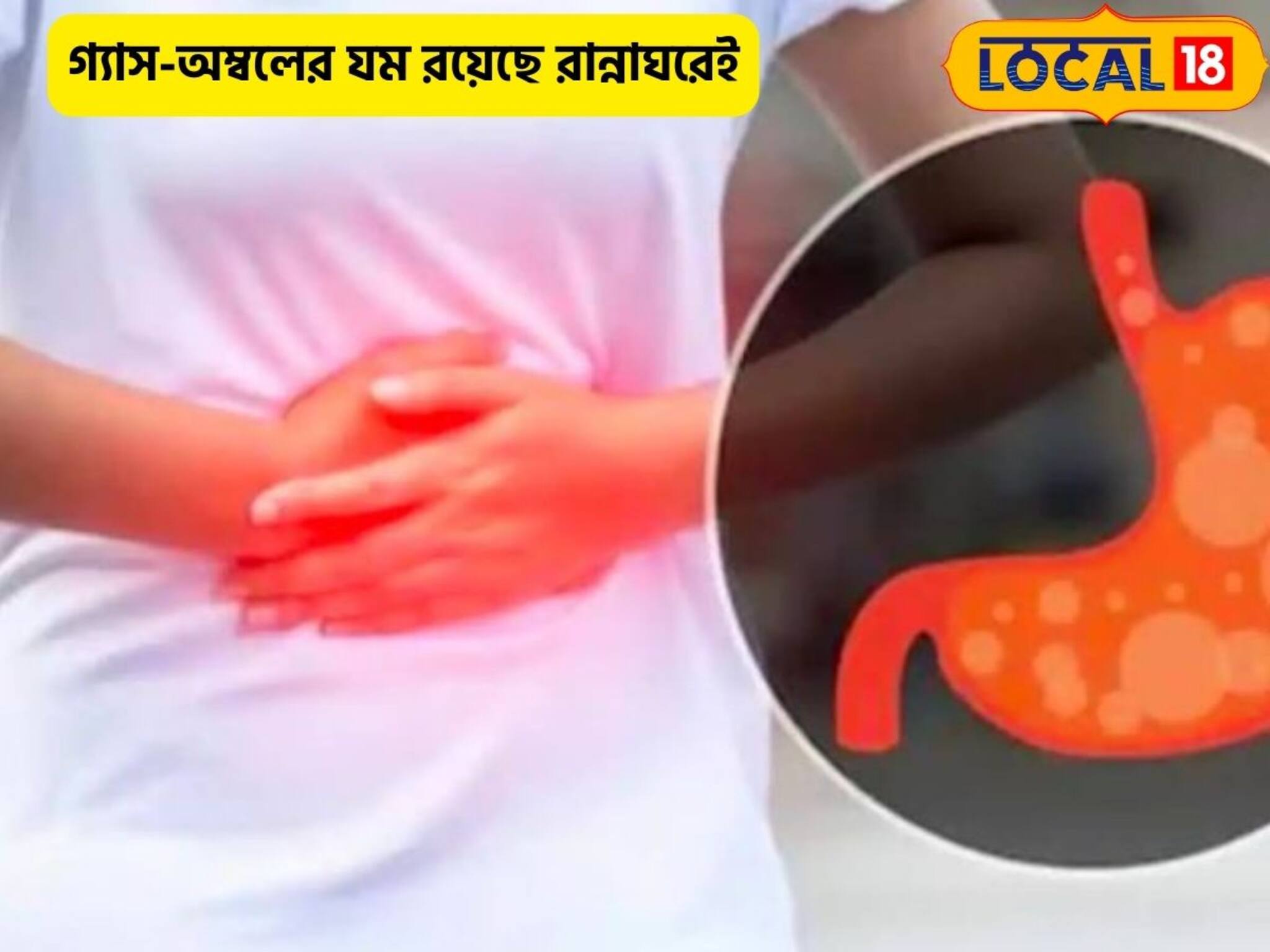 গ্যাস-অম্বলের পালাবে লেজ গুটিয়ে! শুধু ভরসা রাখুন রান্নাঘরের কয়েকটি মশলায়