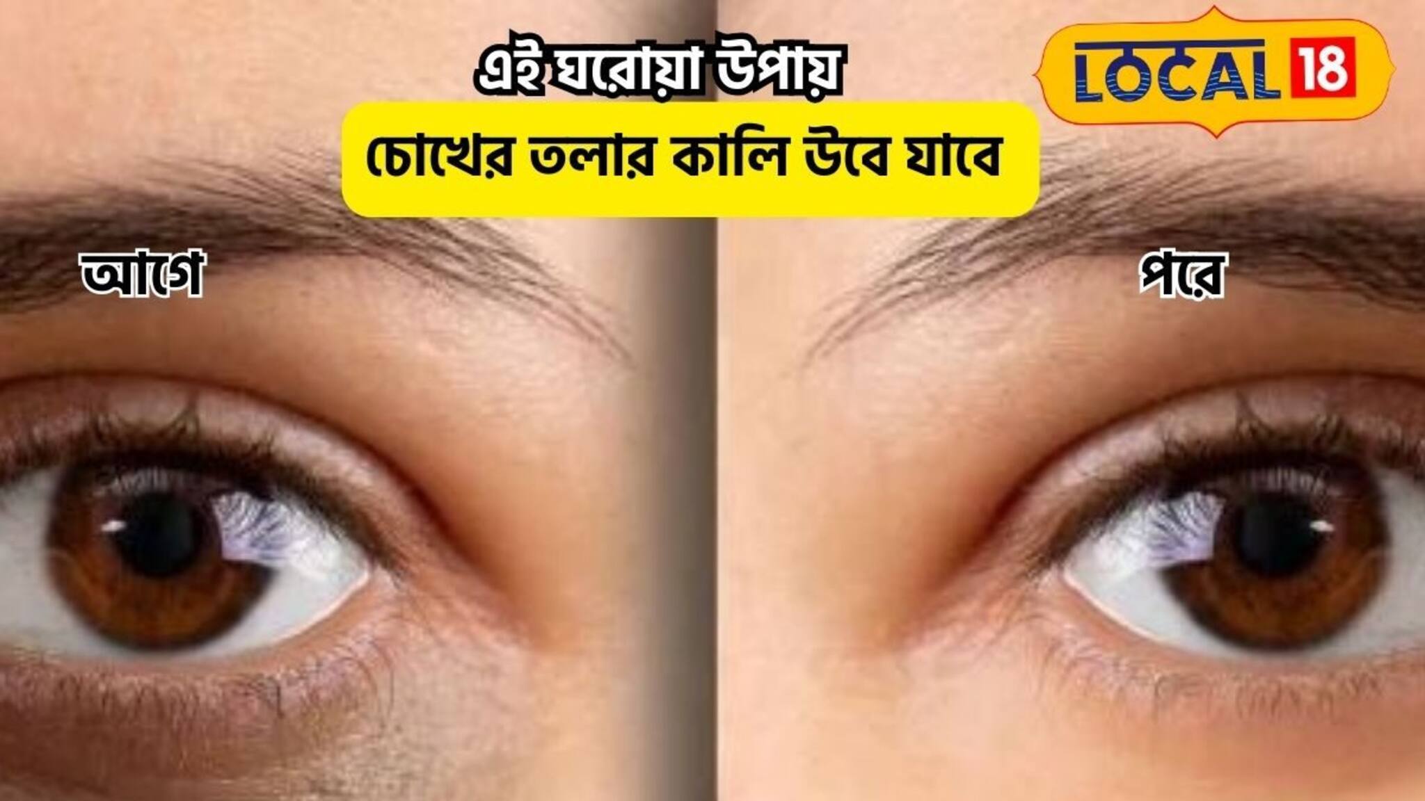 হাতের কাছে 'ম্যাজিক' উপাদান!চোখের তলার কালি উবে যাবে নিমেষে,মুখ হবে নিটোল,সুন্দর
