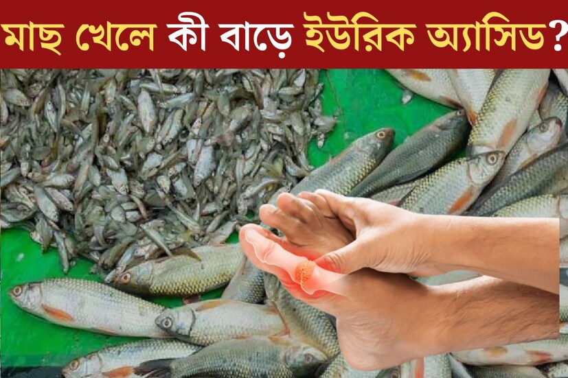 বাঙালির পাতে সারাবছরই থাকে মাছ। তবে বর্ষায় মাছের কদর আরও বাড়ে। বৃষ্টির মরশুমে বাজারেও ইলিশ থেকে চিংড়ি সব মাছই পাওয়া যায় ঢালাও। অন‍্যদিকে ইউরিক অ‍্যাসিড বেড়ে যাওয়াও বর্তমানে একটি অতি চেনা সমস‍্যা। 