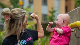 মৃত্যুর কোলে ঢলে পড়ল জনপ্রিয় টিকটক তারকা