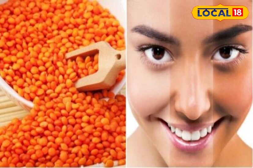 এক কাপ মসুর ডালে থাকে ২৩০ গ্রাম ক্যালোরি, প্রায় ১৫ গ্রাম ফাইবার এবং প্রায় ১৭ গ্রাম প্রোটিন থাকে। আয়রন ও প্রোটিন সমৃদ্ধ এই মুসুর ডাল নিরামিষদের জন্য আদর্শ পছন্দ।