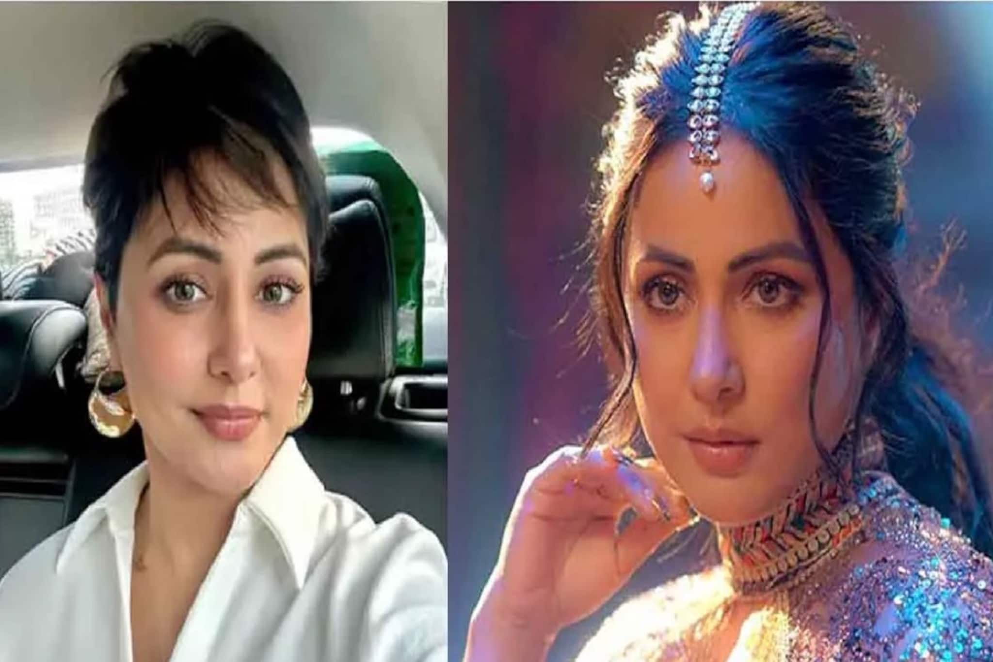 ‘ভাল কিছু আসতে চলেছে জীবনে’; কেমোথেরাপির দাগ দেখিয়ে আচমকা কী বললেন অভিনেত্রী?