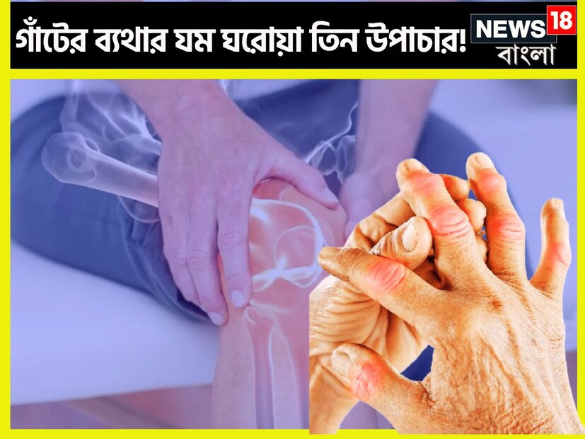 আর্থারইটিসের ব্যাথা যন্ত্রণা যখন শরীরকে ছেঁকে ধরে ঠিক তখনই নানান ধরনের প্রক্রিয়া আছে যা শরীরকে অত্যন্ত ভাল রাখে ৷ প্রতীকী ছবি ৷