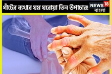 হাত ঠেকলেই ব্যথায় ঝনঝনিয়ে ওঠে, গাঁটে গাঁটে ভয়ঙ্কর ব্যথা, ৩টি ঘরোয়া টোটকা