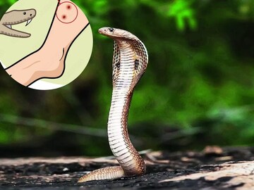 এক ছোবলেই মৃত‍্যু! সাপ কামড়ে দিলে ১০০ মিনিটের মধ‍্যে অবশ‍্যই করুন এই কাজ