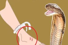 বিষাক্ত সাপের ছোবল! সঙ্গে সঙ্গে কী করা উচিত? কীভাবে কমাতে পারেন বিষের প্রভাব
