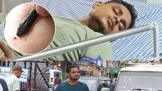 মাত্র ৪০ দিনে ৭ বার সাপের কামড় খেলেন যুবক মাত্র ৪০ দিনে ৭ বার সাপের কামড় খেলেন যুবক