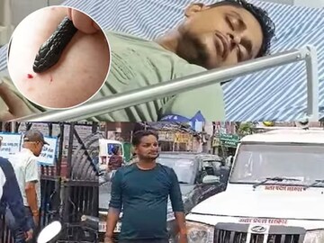 মাত্র ৪০ দিনে ৭ বার সাপের কামড় খেলেন যুবক