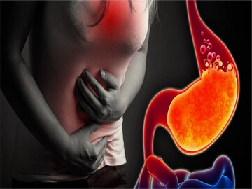 কিছু খেলেই চোঁয়া ঢেঁকুর, মুখে টক টক জল ওঠে! মুঠো মুঠো ওষুধ ছাড়ুন, ৩ উপায়ে মুক্তি