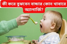কী করে বুঝবেন আপনার বাচ্চার কোন খাবারে অ্যালার্জি? উপায় বলে দিলেন শিশু বিশেষজ্ঞ