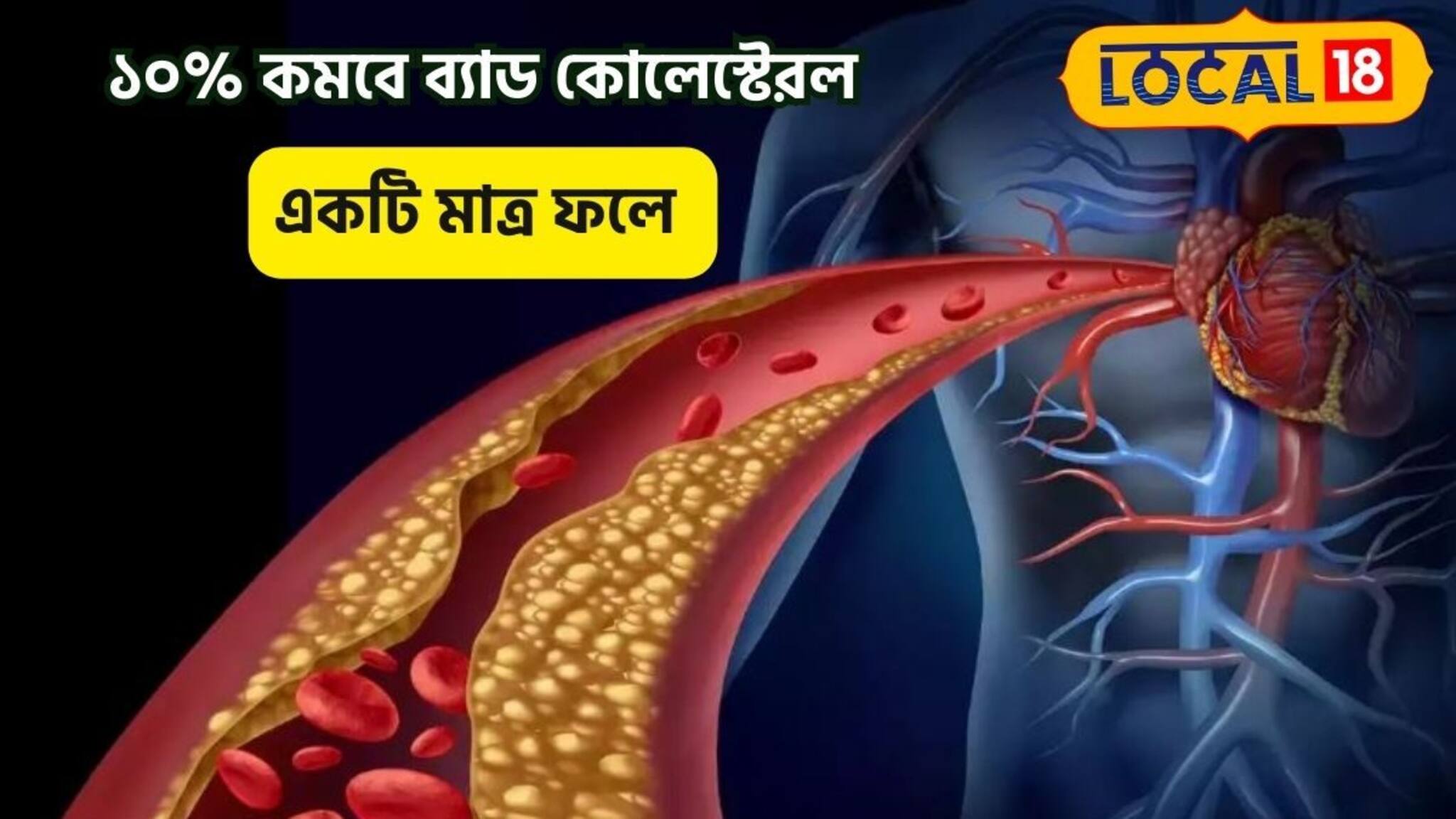 Bad Cholesterol Control Fruit: একটা ফল কমাবে ১০% ব্যাড কোলেস্টেরল! ১ মাসেই চর্বি টেনে বের করবে! ধন্বন্তরি লাল ফল হাতের নাগালে