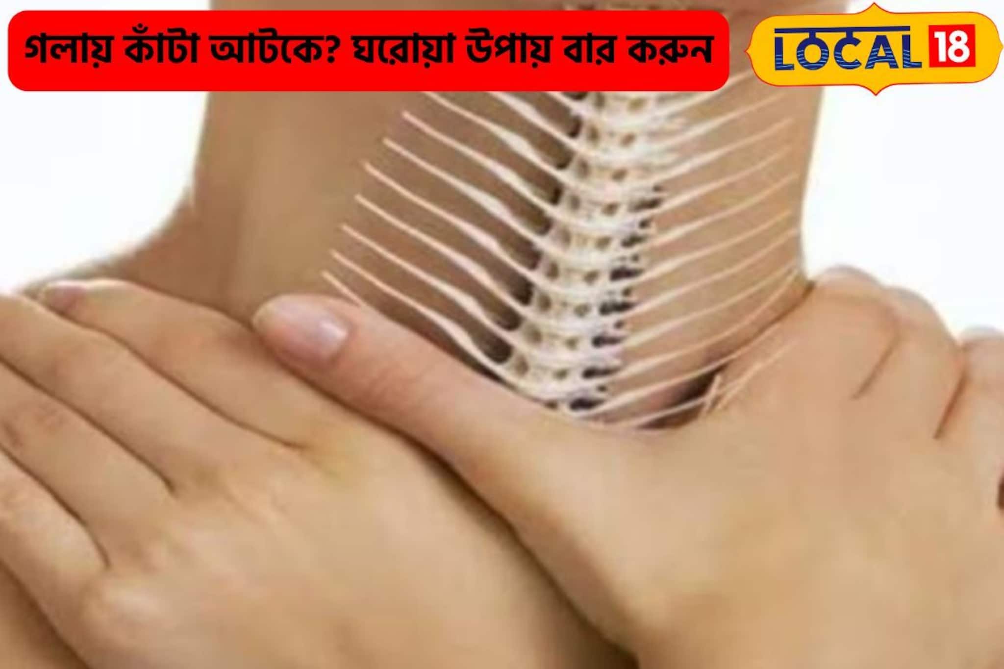 দলা দলা ভাত গিলে নয়, ইলিশের পাতলা কাঁটা গলায় আটকে? ঘরোয়া উপায় 'রিলিফ' পান