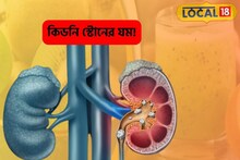 কিডনি স্টোন গলে জল! মহৌষধি 'এই' বিদেশি ফল, রোগব্যাধির যম, খরচের মূল্য পাবেন