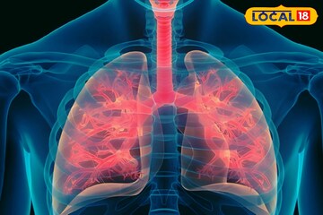 ইদানীং বাড়ছে ফুসফুসের সমস্যা,নিয়মিত খান এই কয়েকটি ফল,শ্বাসযন্ত্র থাকবে তরতাজা ইদানীং বাড়ছে ফুসফুসের সমস্যা,নিয়মিত খান এই কয়েকটি ফল,শ্বাসযন্ত্র থাকবে তরতাজা