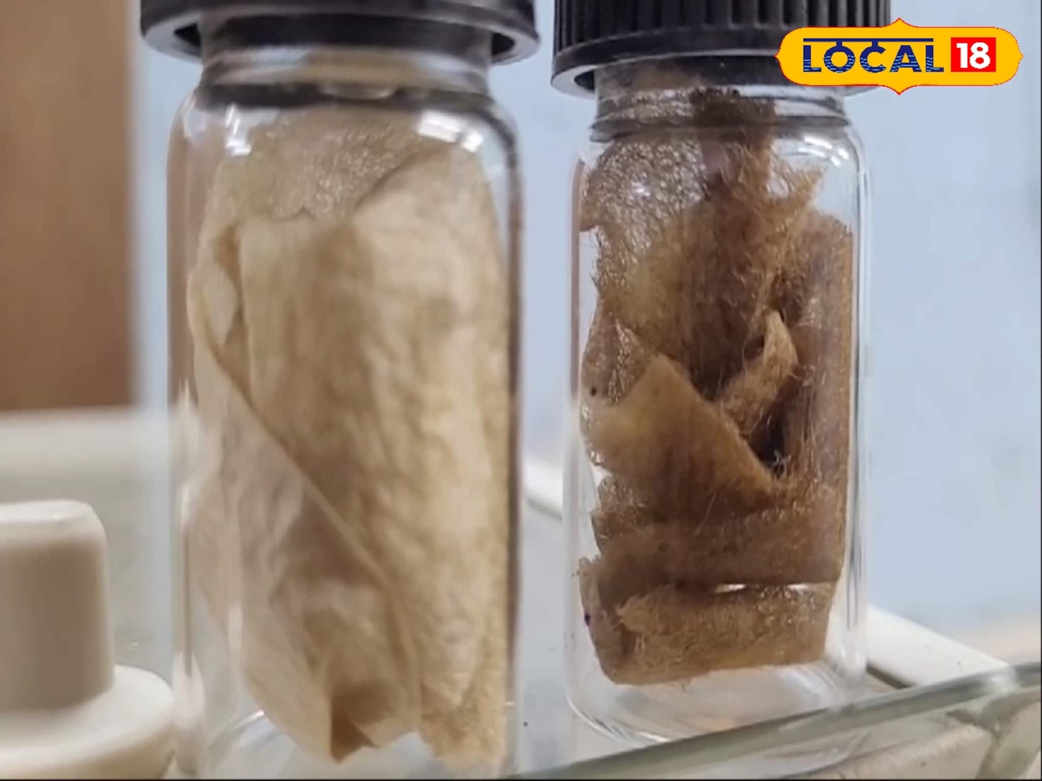 যুগান্তকারী! রেশম গুটি দিয়ে তৈরি ব্যান্ডেজ, ক্ষত শুকবে ১০ দিনেই! মিলল পেটেন্টও