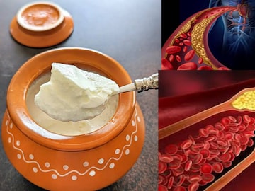 দই খেলে বাড়ে কোলেস্টেরল? কীভাবে দই খাবেন কোলেস্টেরল রোগীরা? বিপদ এড়াতে জানুন দই খেলে বাড়ে কোলেস্টেরল? কীভাবে দই খাবেন কোলেস্টেরল রোগীরা? বিপদ এড়াতে জানুন