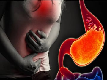 পেট জ্বালা, বুক জ্বালা? মুঠো মুঠো অ্যান্টাসিড না গিলে খেয়ে দেখুন এই খাবারগুলো পেট জ্বালা, বুক জ্বালা? মুঠো মুঠো অ্যান্টাসিড না গিলে খেয়ে দেখুন এই খাবারগুলো