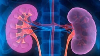 চিকিৎসকরা বলেন, প্রত্যেক ব্যক্তির জীবনে একবার কিংবা দু’বার কিডনিতে পাথর হওয়ার সম্ভাবনা থাকে