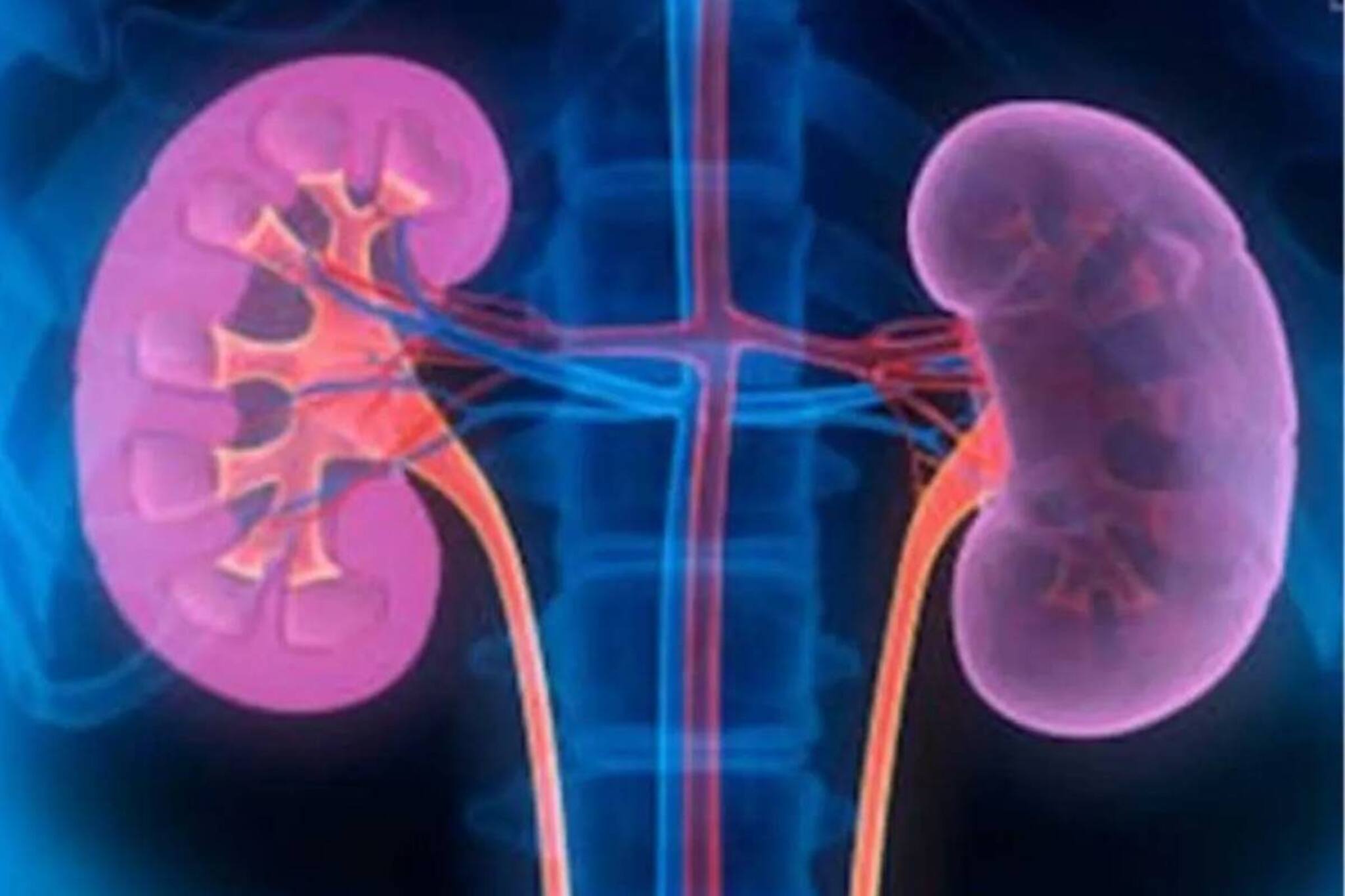 কিডনিতে পাথর? ম্যাজিকের মতো কাজ করবে এই আয়ুর্বেদিক টোটকা, নিমেষে সারবে যন্ত্রণা