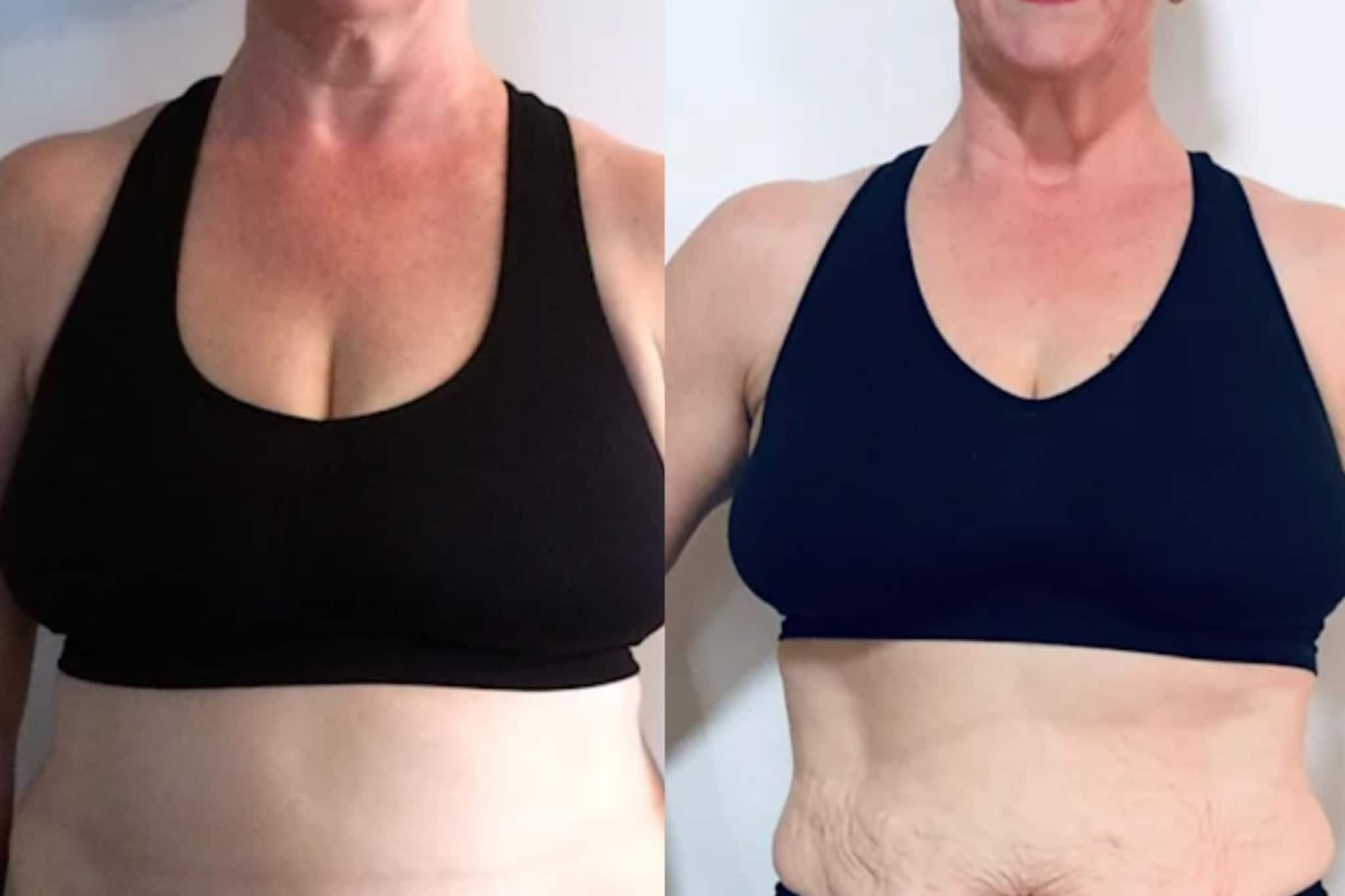 ওষুধ খাবার প্রয়োজন নেই, এই ৫ কাজে মোমের মতো গলবে চর্বি! হরহর করে কমবে ওজন, পেট হবে টানটান