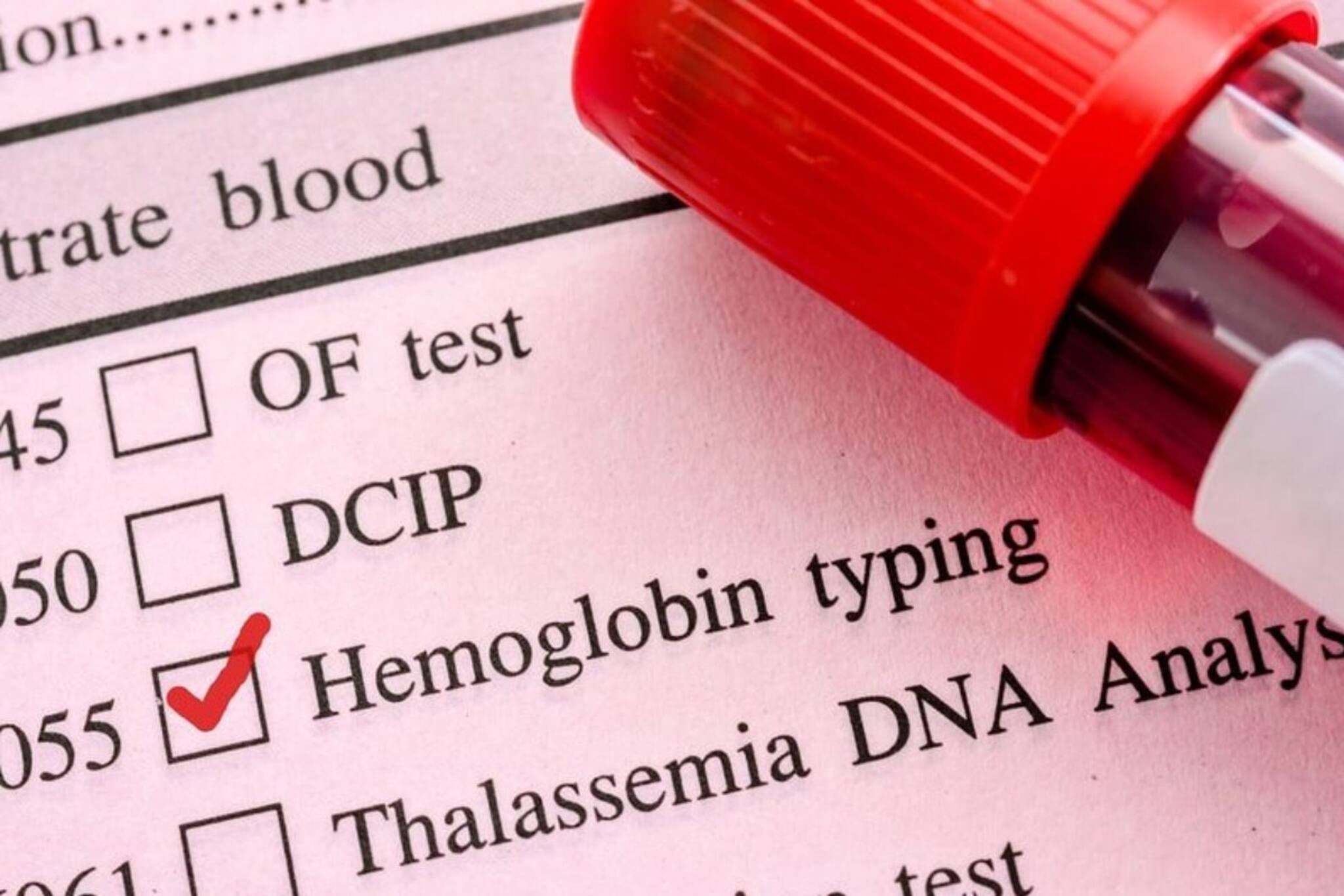 শরীরে রক্ত কম? অ্যানিমিয়ায় ভুগছেন? প্রতিদিন ১০মিনিট দিলেই, হবে সমস‍্যার সমাধান