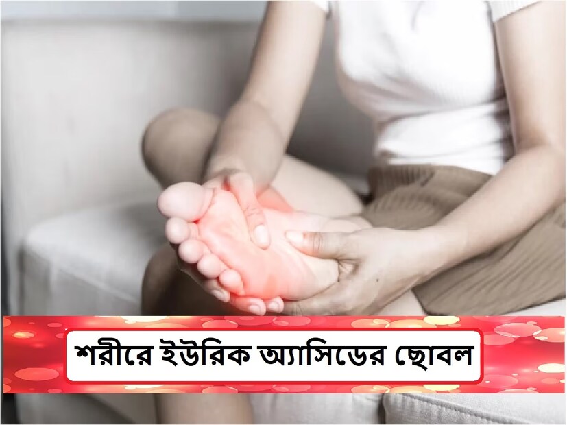 ইউরিক অ্যাসিড হল একটি নাইট্রোজেন যৌগ যা প্রাণী এবং উদ্ভিদের উভয়ের মধ্যেই পাওয়া যায়৷ এটা একটি যা পিউরিন থেকে প্রাপ্ত। এটি মানব শরীরের বিভিন্ন জয়েন্ট জমা হয়৷ পাশাপাশি এটি কিডনিতেও জমা হতে পারে৷ Photo - Representative