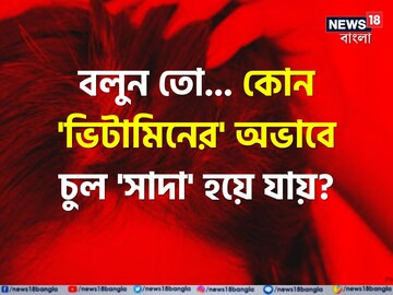 কোন 'ভিটামিনের' অভাবে চুল 'পেকে' যায় বলুন তো..? চমকে দেবে গবেষণা! সতর্ক না হলেই
